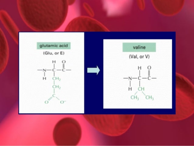hiperesplenismo en nios